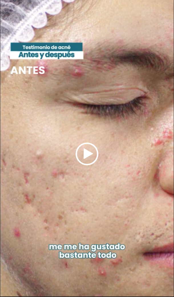 Portada video Andrés